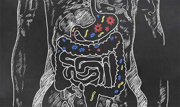 Small Intesting Bacterial Overgrowth Image